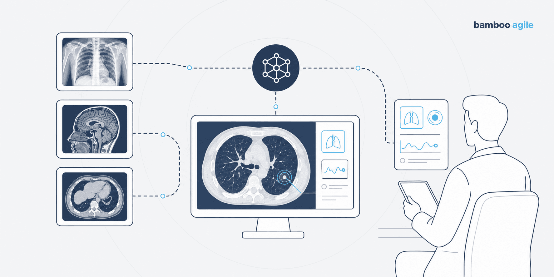 Foundation models in medical imaging